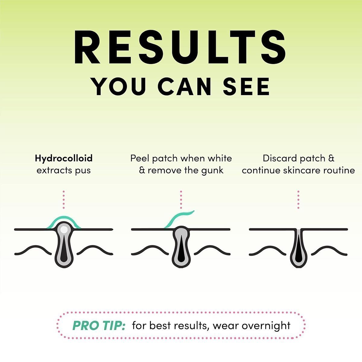 Dots for Spots Acne Patches - Pack of 24 Translucent Hydrocolloid Pimple Patch Spot Treatment Stickers for Face and Body - Fast-Acting, Vegan & Cruelty Free Skin Care - Image 2