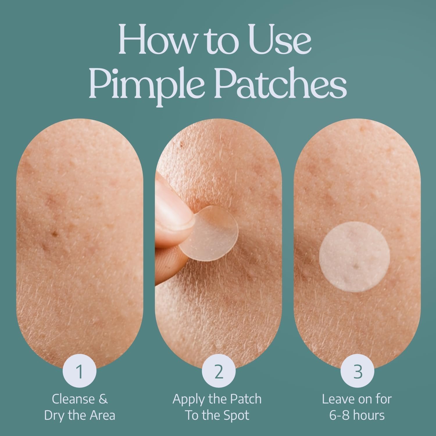 Pimple Patches by Minify - 72 Hydrocolloid Acne Spot Treatment Patches with Salicylic Acid & Tea Tree Oil, Fast Blemish and Spot Treatment - Image 5