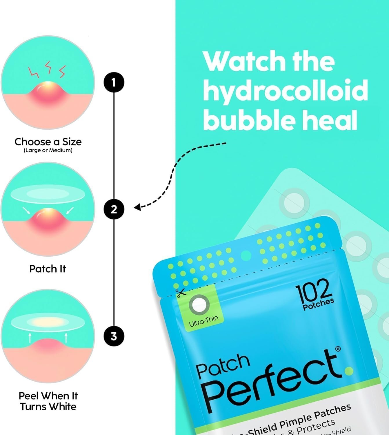 Patch Perfect Spot Patches (102 Count), Vegan & Cruelty-Free Spot Stickers (2 Sizes) - Image 2