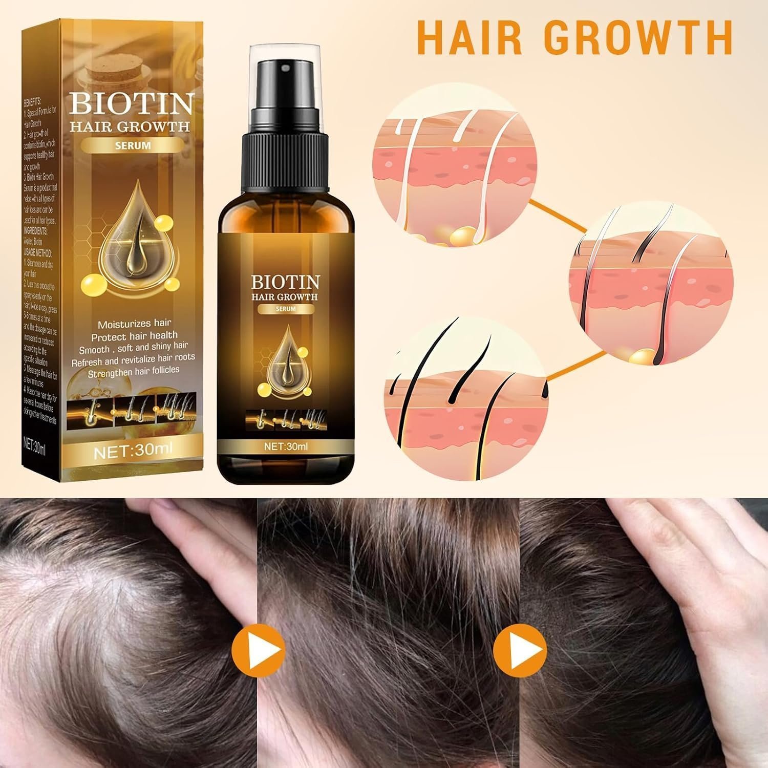 Ninnyi 2PCS 30ml Hair Growth Spray with Biotin, for Thicker Longer Stronger Hair - Image 2