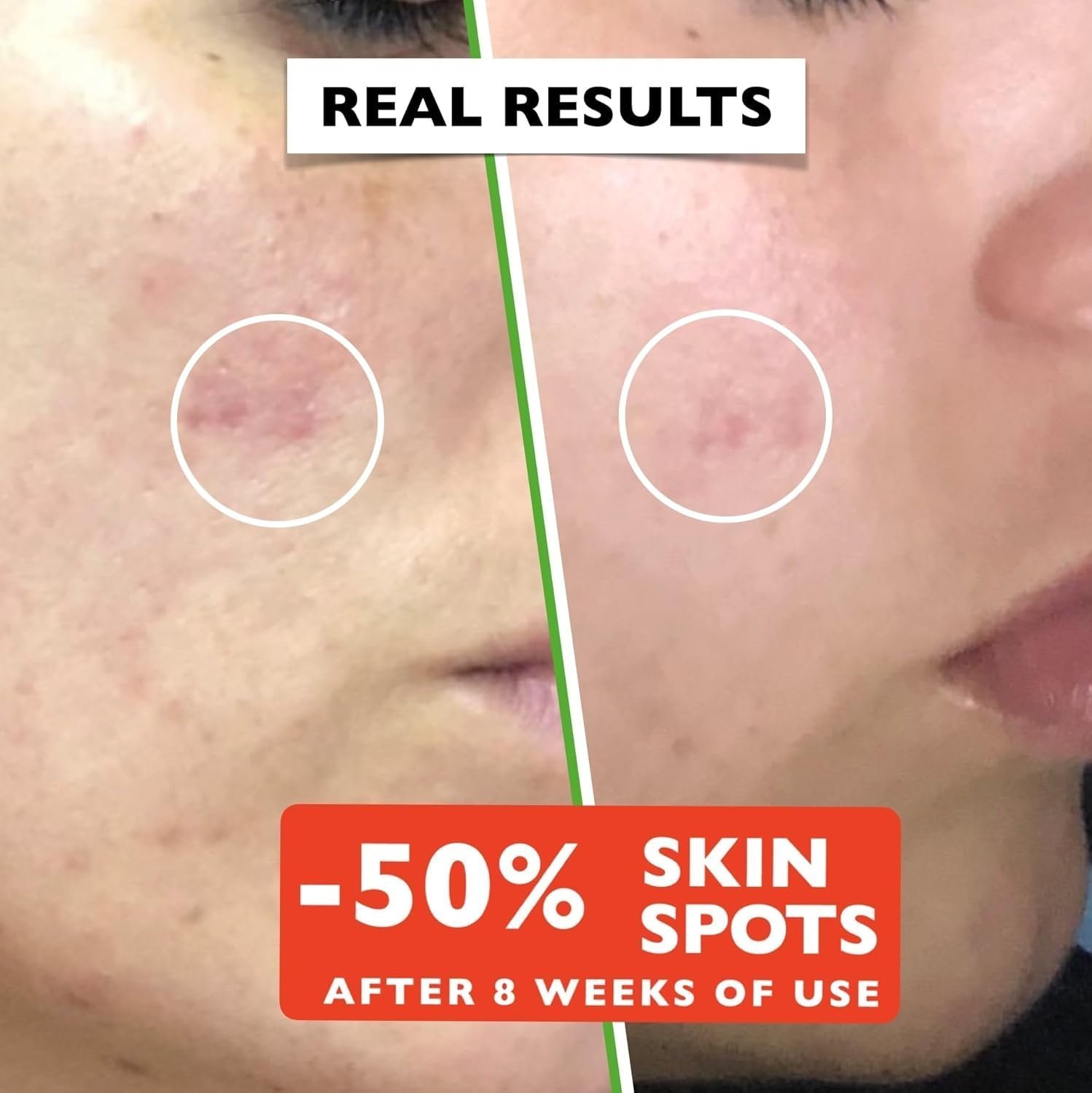 ig 2.11oz. Organic Vitamin C Serum for Face with Hyaluronic Acid & Niacinamide - Brightening Women and Men Skin Care - Image 3