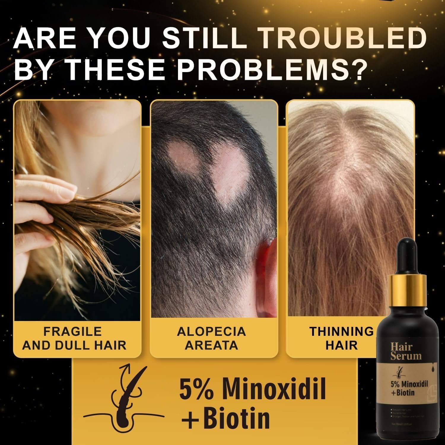 5% Minoxidil + Biotin Hair Serum, Reduces Hair Loss, Nourishes Hair and Scalp, Encourages Hair Growth - Image 4
