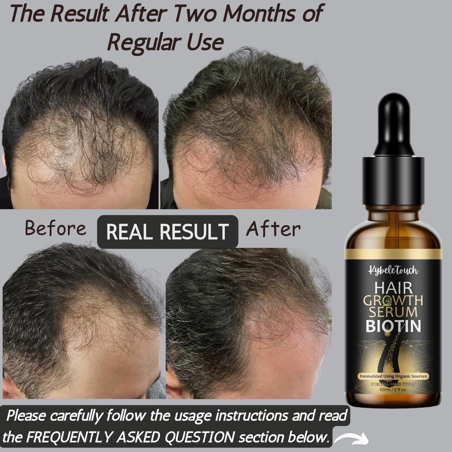 Hair Growth Serum 100% Natural Organic Hair, Hair Loss Treatment For Men,Women - Image 2