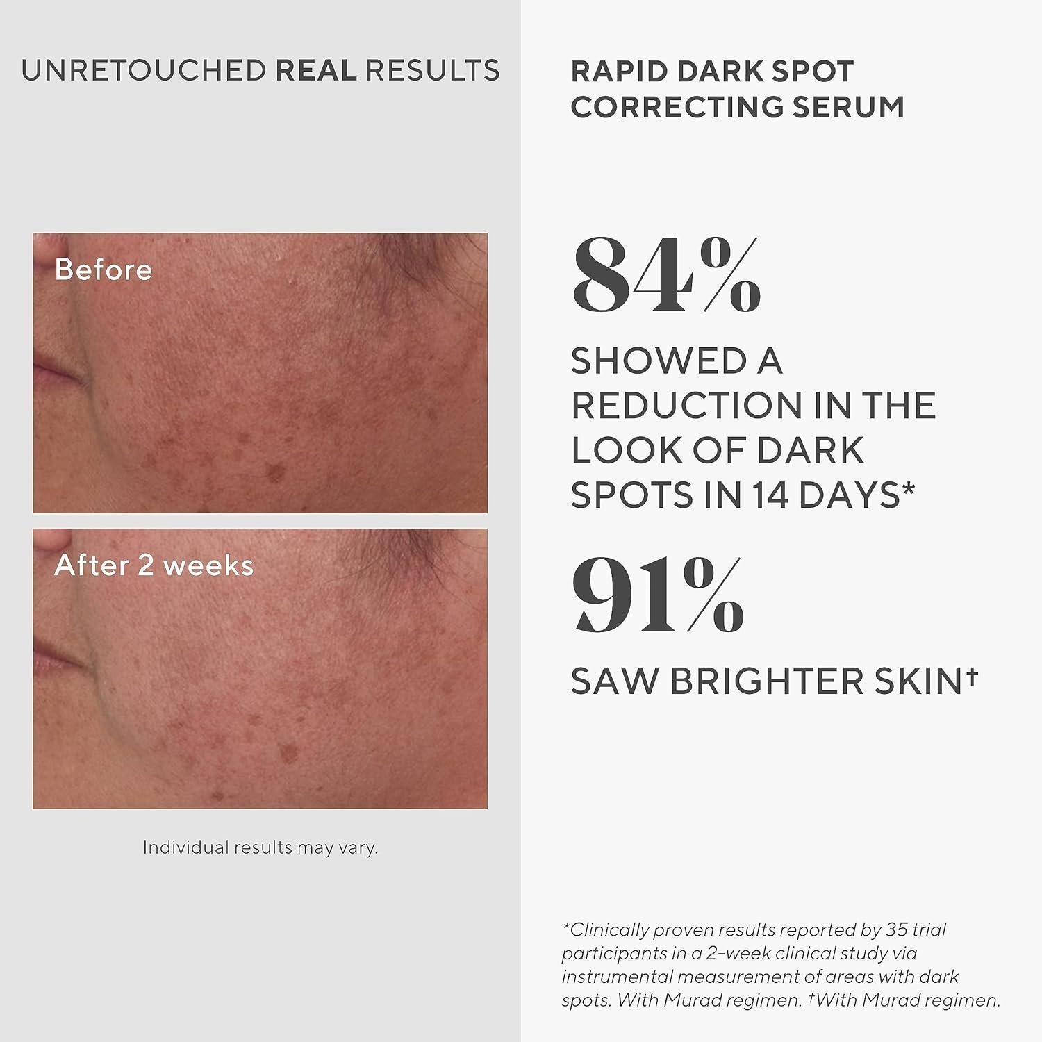 Murad Rapid Dark Spot Correcting Serum, Tranexamic Acid and Glycolic Acid Treatment - Image 4