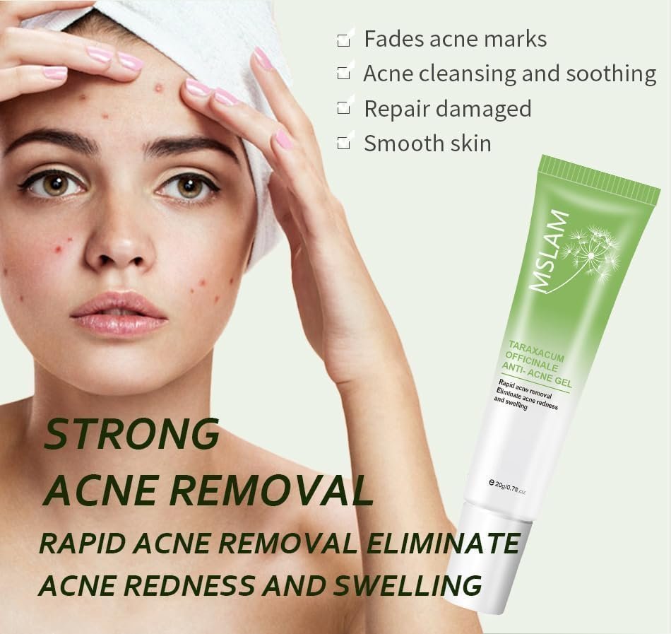 Anti-Acne Face Cream, Anti-Acne Cream For Acne Treatment And Spot Treatment, Skin Treatment Gel Cream For Face Blemishes & Blackheads - Image 2