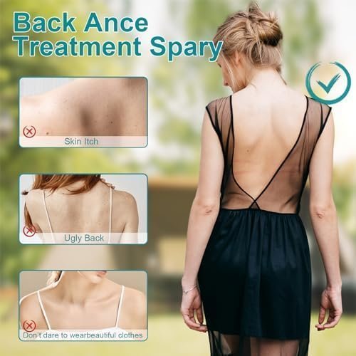 Back Acne Treatment, Back & Body Acne Treatment For Reduce Back Spots & Acne & Lightening Ance Marks - Image 2